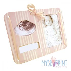   MybbPrint 3 az 1-ben képkeret rózsaszínben - ultrahang kép, fénykép és kórházi karkötő tartó 