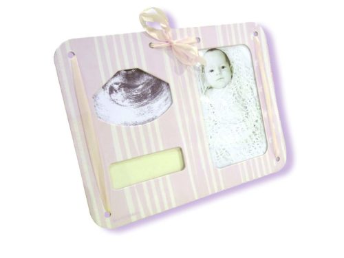 MybbPrint 3 az 1-ben képkeret világoskék színben - ultrahang kép, fénykép és kórházi karkötő tartó 